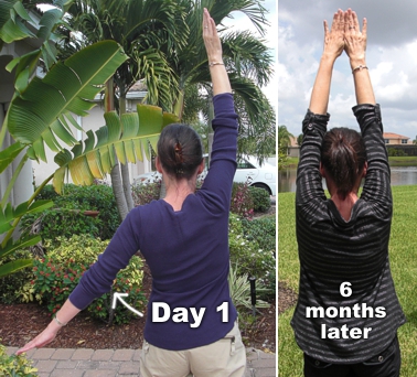 On the LEFT I'm trying to raise both my arms after I tore my rotator cuff. Looking back at this photo, it's hard to believe that's as high as I could raise my left arm. On the RIGHT...that's just 6 months into my rotator cuff exercise program!